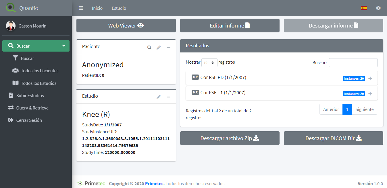 Composición moderna con interfaces de datos, nube y chat IA